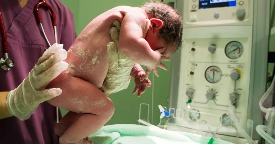 Everything You Need to Know About C-Sections